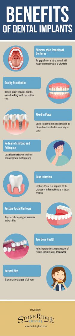 Improve Your Smile With Dental Implants At Stoneridge Dental in Gilbert, AZ