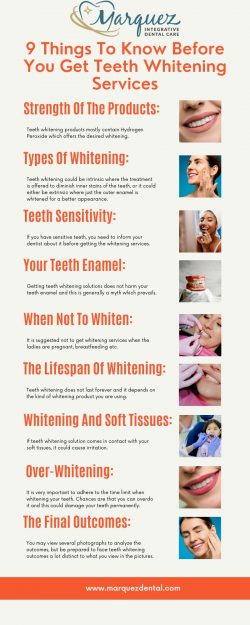 9 Things To Know Before You Get Teeth Whitening Services