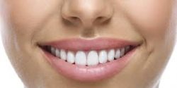 Top Cosmetic Dentist in Houston, TX