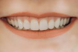 Affordable Dental Implants in Houston | Dental Implants Houston TX