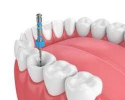 Temporomandibular Joint Disorders TMJ treatment near Sunny Isles …