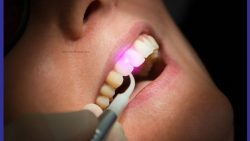 Laser Dental Clinic Near Me | Laser Dental Office Near Me Houston TX