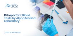 10 Important Blood Tests By Alpha Medical Laboratory