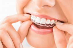 Best Teeth Whitening Near Me in Miami, FL