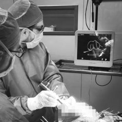 Robotically assisted knee arthroplasty