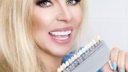 Affordable Dental Veneers Near Me | Dental Veneers Cost Houston