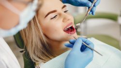 Root Canal Treatment After Care |Emergency Root Canal Dentist Near Me