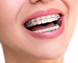 Invisalign Treatment Near Me |Invisalign Dentist Near Me