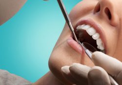 Wisdom Tooth Extraction in Aventura