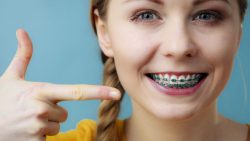 Finding The Best Orthodontist Near Me |Orthodontist Near Me: Find the Best Braces Treatment