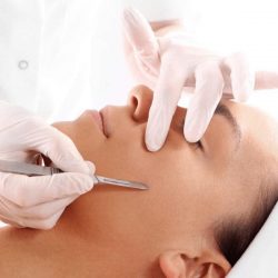 Dermaplaning