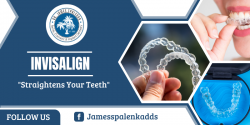 Confident Smile With Perfect Invisalign