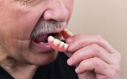 Affordable Dentures Near Me | Immediate Dentures