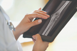 Why Choose Malibu Canyon X-Ray Imaging Services?