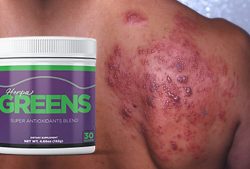 HerpaGreens Review – Where to Buy With Discounted Price?