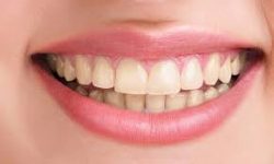 Cosmetic Dentistry: How Does Dental Bonding Work?