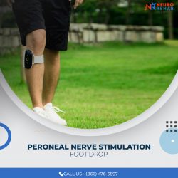 Peroneal Nerve Stimulation Foot Drop