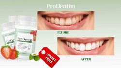 ProDentim Reviews | Does It Work | Supports A Healthy Mouth?