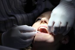 Lanap laser near me – Laser Gum Disease Treatment