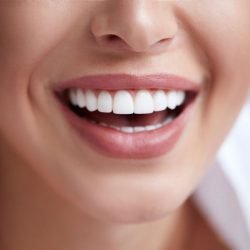 Traditional Veneers Near me | Traditional Veneers Vs. Composite Veneers