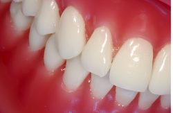 Cosmetic Dentist In Houston TX