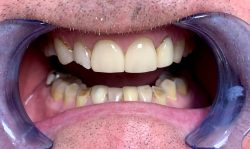 Emergency Local Dentist Near Me | Local Dentist Office in Houston
