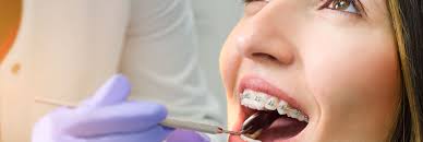 Orthodontic Specialists of Florida – Orthodontic Specialist Of Florida