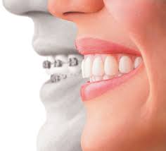 Orthodontist Specialists in Miami, Fl