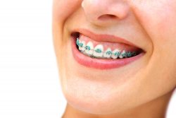 North Miami Beach Dentist | Orthodontist in North Miami