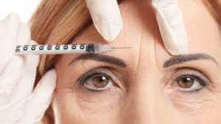 Antiwrinkle Injections