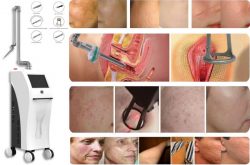 CO2 laser beauty machine Good choice of CO2 fractional laser treatment