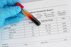 Everything To Know About The Complications Of High Cholesterol