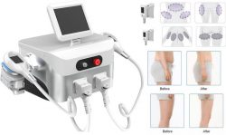 Non-invasive cryolipolysis slimming machine for weight loss