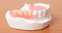 Affordable Dentures Near Me | Implant Supported Dentures in Houston TX