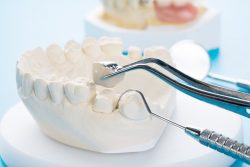 Same-Day Dental Crowns – Same-Day Dental Crowns in Houston TX