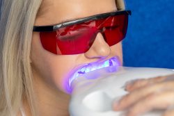 Teeth Whitening in Houston, Tx