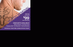 Tattoo removal Killeen