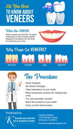 Transform Your Smile with Dental Veneers in Somerset, NJ from Coloman E Kondorossy DMD FAGD