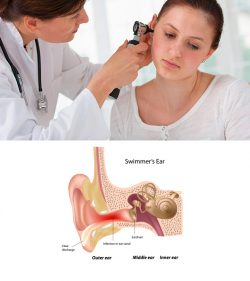 Tvidler Reviews: Does Ear Infection Cause Hearing Loss?