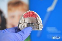 Orthodontics Specialists Of Fl
