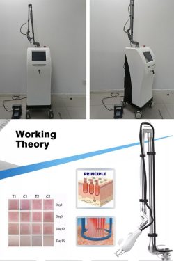 Is the effect of CO2 laser scar removal good?