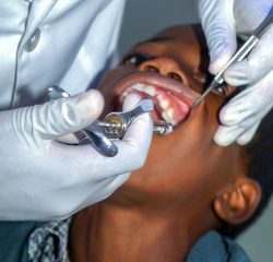 Emergency Pediatric Dentist Near Me | Affordable Dentist Near Me | Dentist Near Me In Houston