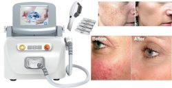 IPL photorejuvenation and treatment of dermatology