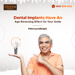 Dental Implants