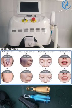 Q-switch Nd:YAG Laser dermatology Machine treatment Pigmented Lesions