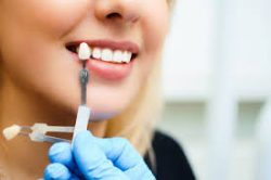 Best Cosmetic Dentist Near Me | Cosmetic Dentistry Houston TX