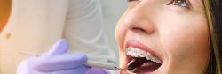 Orthodontist Specialists in Miami, Fl | Orthodontist Surgeons