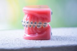 Orthodontists Specialists Of Florida | Expert Orthodontist in Miami