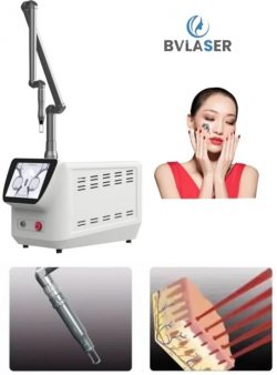 Pico laser treatment