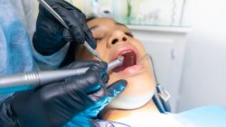 General Dentistry Services Houston, TX | Sedation Dentistry Houston TX